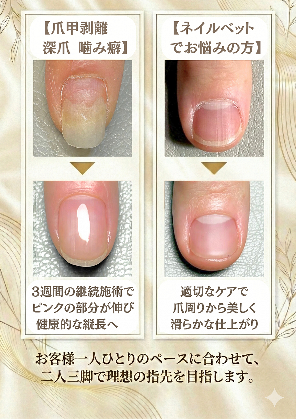 ネイルベット育成